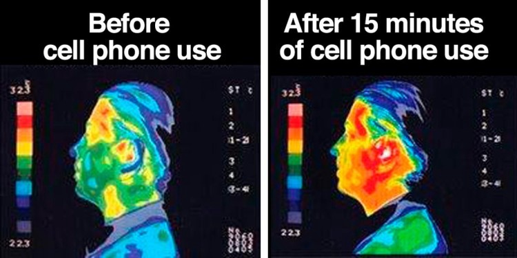 Effets thermiques de l'utilisation du téléphone portable